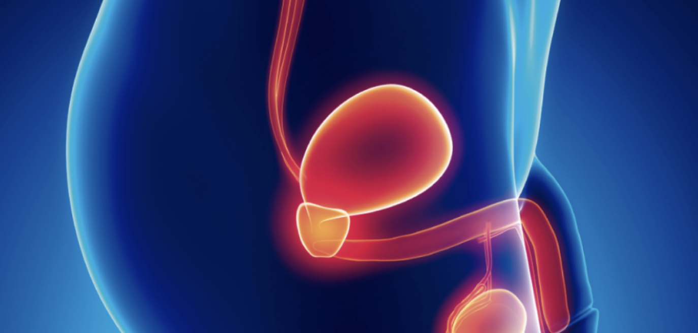 Detectar el cáncer de próstata a tiempo puede cambiar la historia
